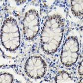 Anti-SATB2 antibody produced in rabbit