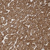 Anti-OFD1 antibody produced in rabbit Prestige Antibodies® Powered by Atlas Antibodies, affinity isolated antibody, buffered aqueous glycerol solution