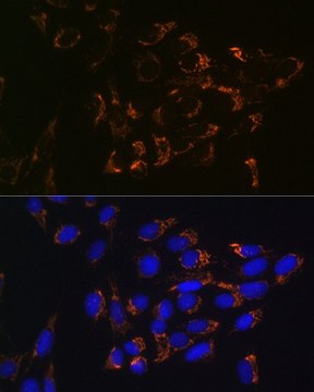 Anti-Glutaminase (GLS) antibody produced in rabbit