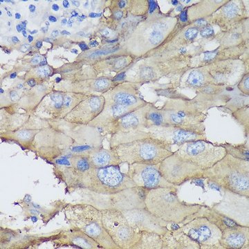 Anti-CEACAM5 antibody produced in mouse