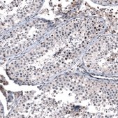 Monoclonal Anti-GLI1 antibody produced in mouse Prestige Antibodies® Powered by Atlas Antibodies, clone CL12193, purified immunoglobulin, buffered aqueous glycerol solution