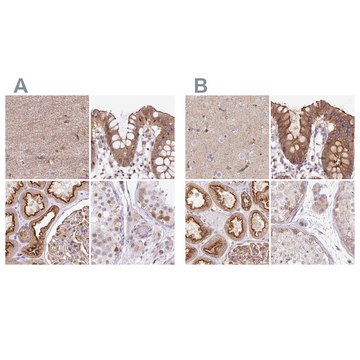 Anti-HIP1R antibody produced in rabbit Prestige Antibodies&#174; Powered by Atlas Antibodies, affinity isolated antibody, buffered aqueous glycerol solution