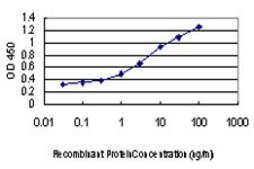 Monoclonal Anti-DAPK1 antibody produced in mouse clone 2E7, purified immunoglobulin, buffered aqueous solution
