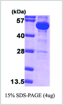 G6PD from E. coli recombinant, expressed in E. coli, &#8805;90% (SDS-PAGE)