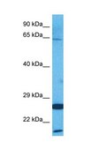 Anti-AMFR antibody produced in rabbit IgG fraction of antiserum