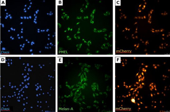 sBT-RMS Spontaneous Brain-tropic RET Melanoma-sorted Mouse Cell Line