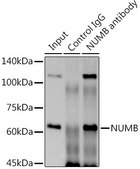Anti-NUMB Antibody, clone 9X1Y0, Rabbit Monoclonal