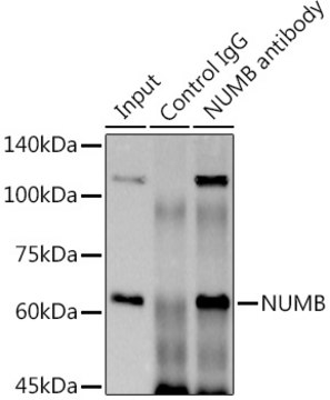 Anti-NUMB Antibody, clone 9X1Y0, Rabbit Monoclonal