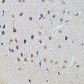 Anti-STAT1 antibody produced in rabbit