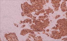 TROP2 (EP431) Rabbit Monoclonal Primary Antibody