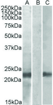 Anti-CST8 antibody produced in goat affinity isolated antibody, buffered aqueous solution