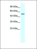 Anti-ANKRD11 antibody produced in rabbit IgG fraction of antiserum