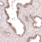 Anti-ACSL3 antibody produced in rabbit Prestige Antibodies® Powered by Atlas Antibodies, affinity isolated antibody, buffered aqueous glycerol solution
