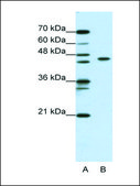 Anti-ZBTB9 (AB1) antibody produced in rabbit affinity isolated antibody