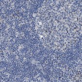 Anti-SFXN2 antibody produced in rabbit Prestige Antibodies® Powered by Atlas Antibodies, affinity isolated antibody, buffered aqueous glycerol solution