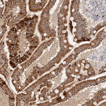 Anti-TRIM41 antibody produced in rabbit Prestige Antibodies&#174; Powered by Atlas Antibodies, affinity isolated antibody, buffered aqueous glycerol solution, Ab2