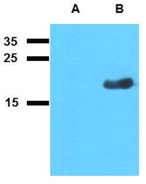 Anti-Acr2 (M. tuberculosis) antibody produced in rabbit