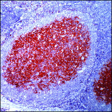 Anti-CD23 antibody, Rabbit monoclonal recombinant, expressed in proprietary host, clone SP23, tissue culture supernatant