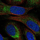Anti-NOA1 antibody produced in rabbit Prestige Antibodies® Powered by Atlas Antibodies, affinity isolated antibody, buffered aqueous glycerol solution