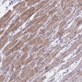 Anti-ST6GALNAC3 antibody produced in rabbit Prestige Antibodies® Powered by Atlas Antibodies, affinity isolated antibody, buffered aqueous glycerol solution