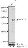 Anti-Phospho-TAK1-T187 antibody produced in rabbit
