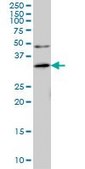 Monoclonal Anti-ANKRA2 antibody produced in mouse clone 1D11, purified immunoglobulin, buffered aqueous solution