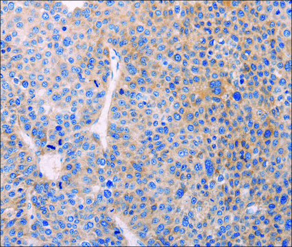 Anti-ADCY1 antibody produced in rabbit affinity isolated antibody