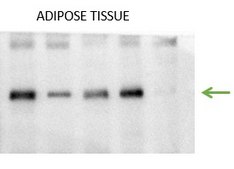 Anti-SUCNR1/GPR91 Antibody, clone 1N21 ZooMAb® Rabbit Monoclonal recombinant, expressed in HEK 293 cells
