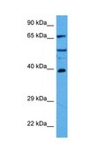 Anti-HDAC2 antibody produced in rabbit affinity isolated antibody