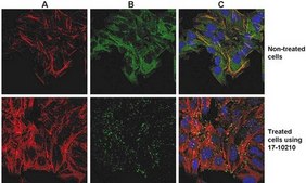 ProteoExtract® Native Cytoskeleton Enrichment The ProteoExtract Native Cytoskeleton Enrichment &amp; Staining Kit provides cytoskeleton purification detergent buffers that retain focal adhesion &amp; actin-associated proteins while removing soluble cytoplasmic &amp; nuclear proteins from the cell.