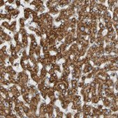 Anti-SSR1 antibody produced in rabbit Prestige Antibodies® Powered by Atlas Antibodies, affinity isolated antibody, buffered aqueous glycerol solution