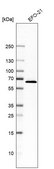 Anti-C14orf159 antibody produced in rabbit Prestige Antibodies® Powered by Atlas Antibodies, affinity isolated antibody, buffered aqueous glycerol solution