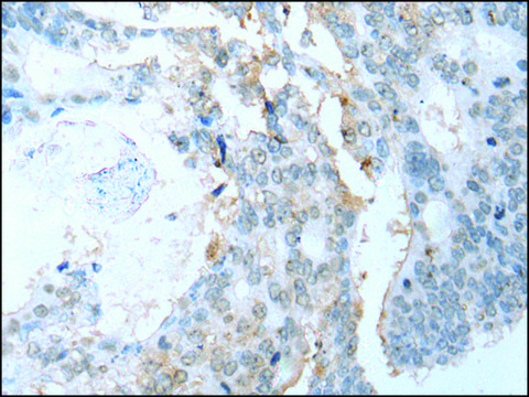 Anti-SYCP2 affinity isolated antibody