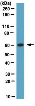 Anti-WAS protein family homolog 1 (CT) Antibody from rabbit