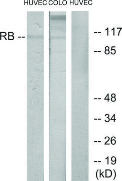 Anti-Retinoblastoma antibody produced in rabbit affinity isolated antibody