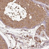 Anti-ATAT1 antibody produced in rabbit Prestige Antibodies® Powered by Atlas Antibodies, affinity isolated antibody, buffered aqueous glycerol solution