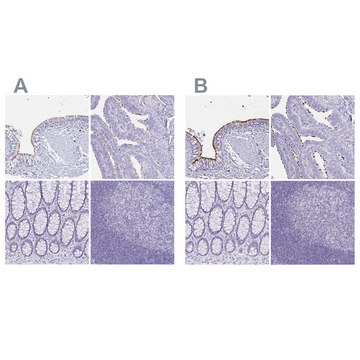 Anti-CCDC39 antibody produced in rabbit Prestige Antibodies&#174; Powered by Atlas Antibodies, affinity isolated antibody, buffered aqueous glycerol solution