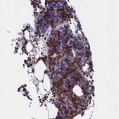 Anti-TYROBP antibody produced in rabbit Prestige Antibodies® Powered by Atlas Antibodies, affinity isolated antibody, buffered aqueous glycerol solution