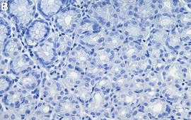 Anti-QPCTL Antibody, clone 5M19 ZooMAb® Rabbit Monoclonal recombinant, expressed in HEK 293 cells