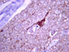 Anti-Tau phospho Threonine 231 Antibody Chemicon®, from rabbit