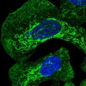 Anti-OTULIN antibody produced in rabbit Prestige Antibodies® Powered by Atlas Antibodies, affinity isolated antibody, buffered aqueous glycerol solution