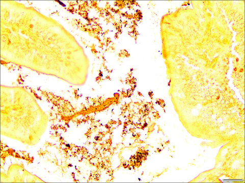 Helicobacter TISSUE-TROL&#8482; Control Slides mouse intenstine tissue containing Helicobacter pylori