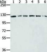 Anti-RNF20 affinity isolated antibody