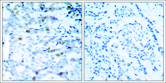 Anti-phospho-CDC2 (pThr161) antibody produced in rabbit affinity isolated antibody