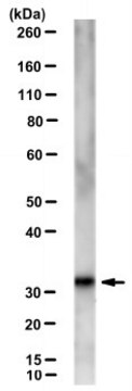 Anti-Rhinovirus Capsid VP1 Antibody, clone HRV-18003