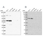 Anti-PUF60 antibody produced in rabbit Prestige Antibodies® Powered by Atlas Antibodies, affinity isolated antibody, buffered aqueous glycerol solution