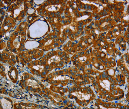 Anti-CENPU antibody produced in rabbit affinity isolated antibody