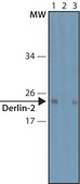 Anti-Derlin-2 antibody produced in rabbit ~1.0 mg/mL, affinity isolated antibody, buffered aqueous solution