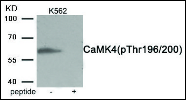 抗-磷酸化-CaMK4 (pThr196/200) 兔抗 affinity isolated antibody