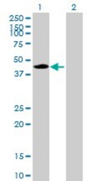 Anti-CPA1 antibody produced in mouse purified immunoglobulin, buffered aqueous solution